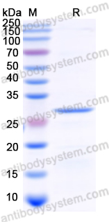 Recombinant Human ALOX5 Protein, N-His