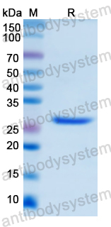 Recombinant Human UCHL1 Protein, N-His