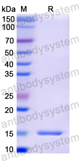 Recombinant Human FURIN Protein, N-His