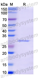 Recombinant Human ALDOC Protein, N-His