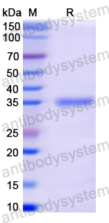 Recombinant Human C4A Protein, N-His