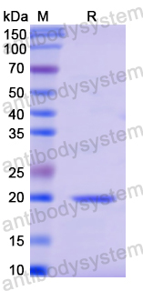 Recombinant Human POTEJ Protein, N-His