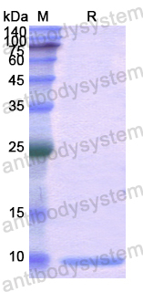 Recombinant Human UBB Protein, N-His