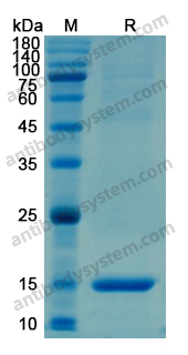 Recombinant Human SAA1 Protein, N-His