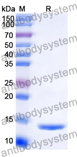 Recombinant Human SAA1 Protein, N-His
