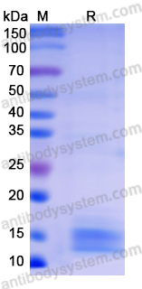 Recombinant Human SAA2 Protein, N-His