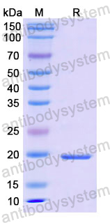 Recombinant Human CALM1 Protein, N-His