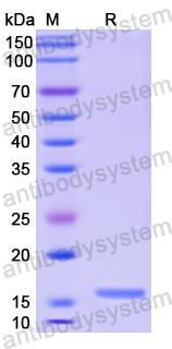 Recombinant Human CALCB Protein, N-His