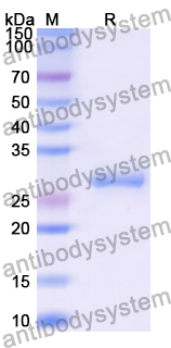Recombinant Human GZMB Protein, C-His