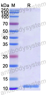 Recombinant Human IL8/CXCL8 Protein, N-His