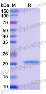 Recombinant Human GAA Protein, N-His