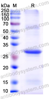 Recombinant Human AR Protein, N-His