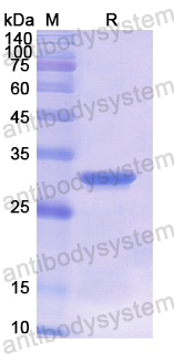 Recombinant Human HLA-C Protein, N-His