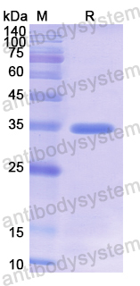 Recombinant Human ACR Protein, N-His