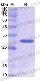 Recombinant Human ARAF Protein, N-His