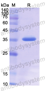 Recombinant Human OPN/SPP1 Protein, N-His