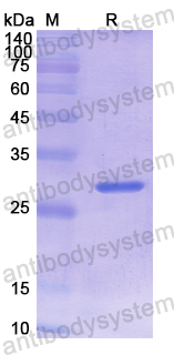Recombinant Human DLAT Protein, N-His
