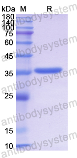 Recombinant Human COX5B Protein, N-GST