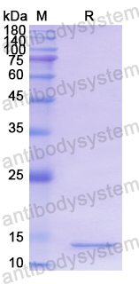 Recombinant Human MGST1 Protein, N-His