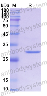 Recombinant Human CYP2D6 Protein, N-His