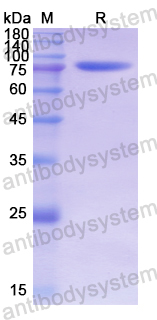 Recombinant Human MAPT/Tau/PHF-tau Protein, C-His