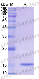 Recombinant Human MAPT/Tau/PHF-tau Protein, N-His