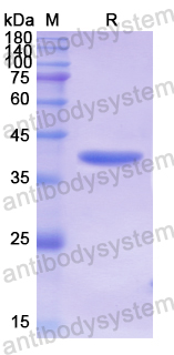 Recombinant Human C7 Protein, N-His