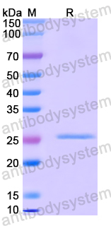 Recombinant Human C7/Complement component C7 Protein, N-His-SUMO