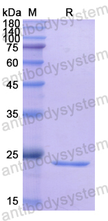 Recombinant Human TFPI Protein, N-His