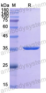 Recombinant Human ALPG Protein, N-His