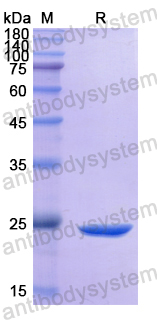 Recombinant Human CD117/KIT Protein, N-His