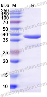 Recombinant Human RBP3 Protein, N-His