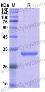 Recombinant Human ESD Protein, N-His