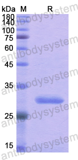 Recombinant Human RARB Protein, N-His