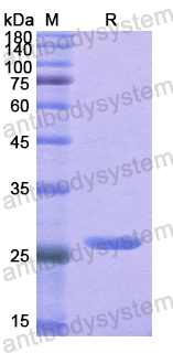 Recombinant Human THRB Protein, N-His