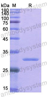 Recombinant Human GHR Protein, N-His