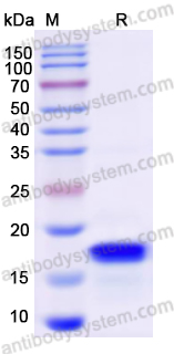 Recombinant Human IRF1 Protein, N-His