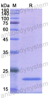 Recombinant Human MYL2 Protein, N-His