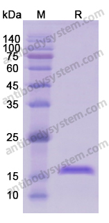 Recombinant Human CD8B Protein, N-His