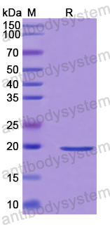 Recombinant Human IAPP Protein, N-His-SUMO