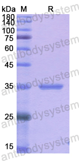 Recombinant Human HSPA5 Protein, N-His