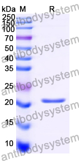 Recombinant Human GRP78/HSPA5 Protein, N-His