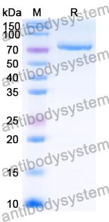Recombinant Human GRP78/HSPA5 Protein, N-His