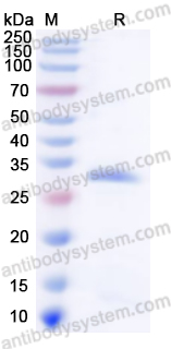 Recombinant Human LAMC1 Protein, N-His