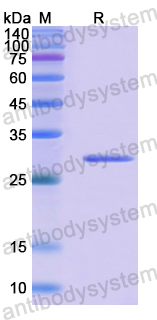 Recombinant Human LAMC1 Protein, N-His