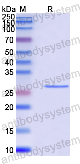 Recombinant Human LAMC1 Protein, N-His