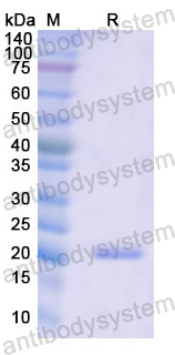 Recombinant Human MYH3 Protein, N-His