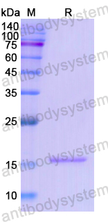 Recombinant Human MAP2 Protein, N-His