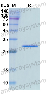 Recombinant Human EGR2 Protein, N-His