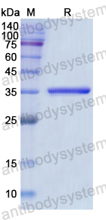 Recombinant Human EPB41 Protein, N-His